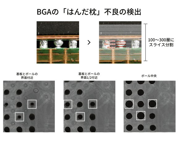 BGAの「はんだ枕」不良の検出