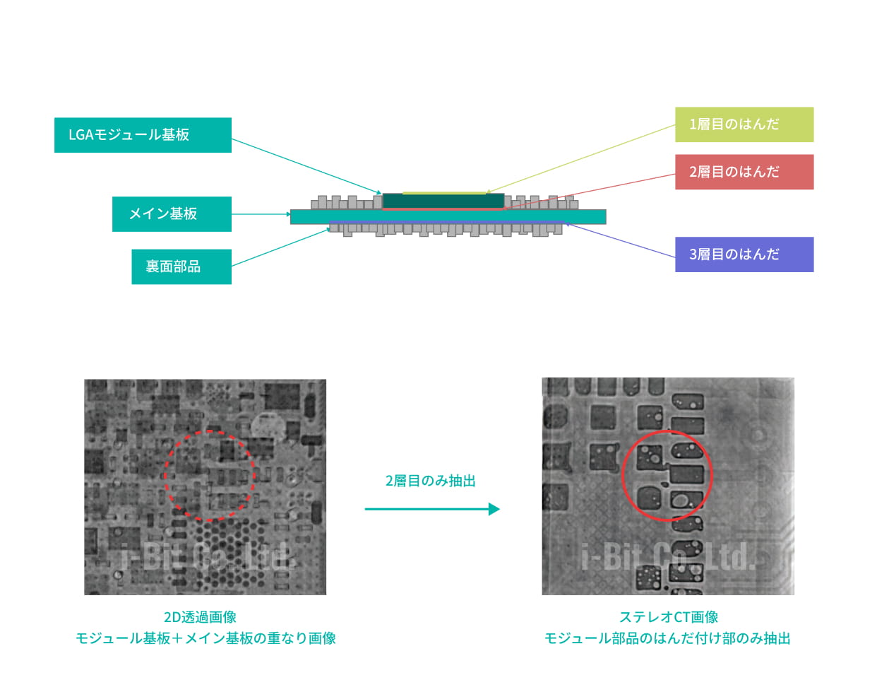 Ｘ線ステレオCT方式®︎独自の3層はんだ部の分離機能